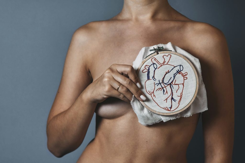 breast reconstruction image